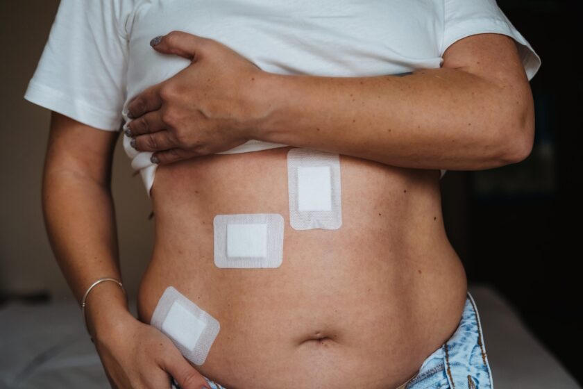 Bariatric surgery and perceived pain