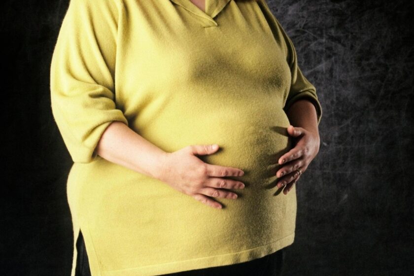 How does bariatric surgery affect fertility