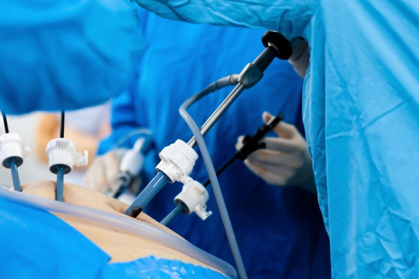 Is there pain after bariatric surgery