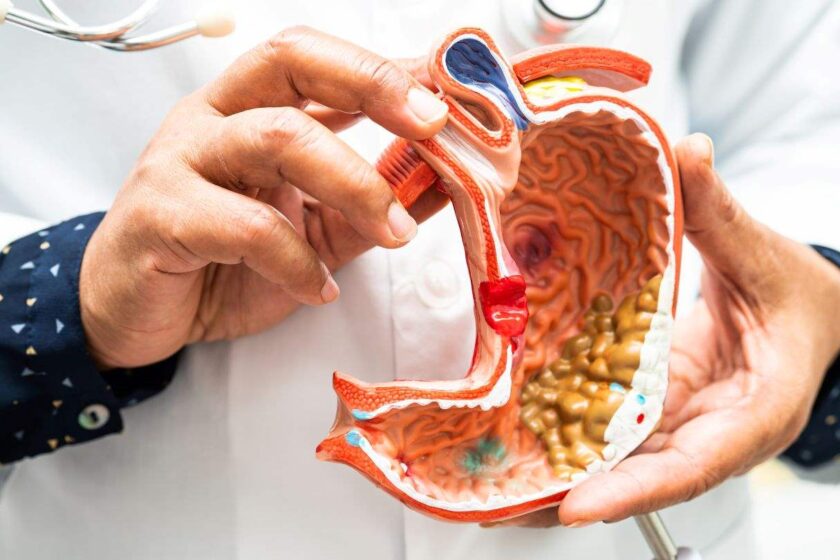 Risks of bariatric surgery