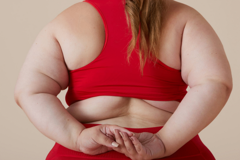 What should be the BMI for weight loss surgery