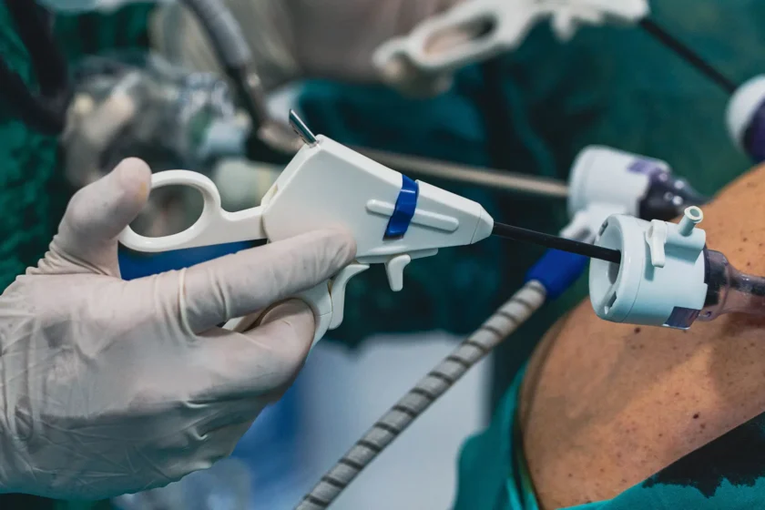 recovery after bariatric surgery