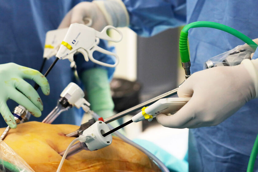 recovery process after bariatric surgery