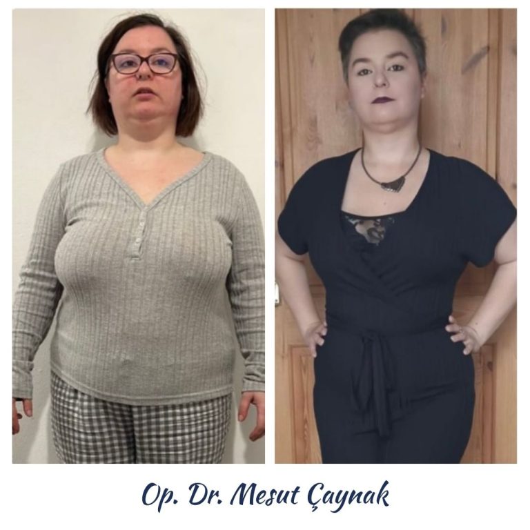 Before & After 1