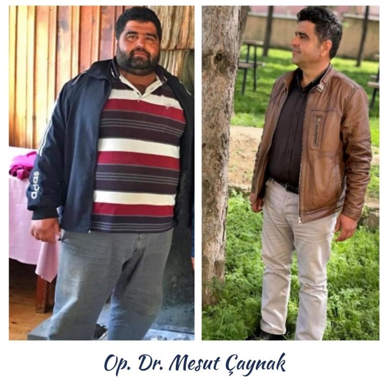 Before & After 2