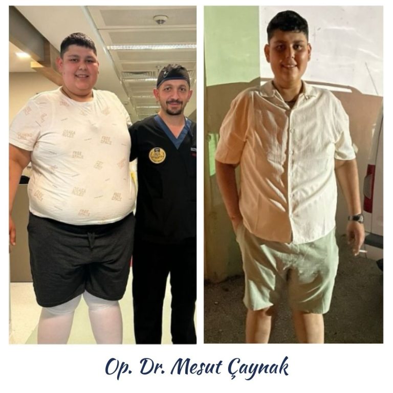 Before & After 3