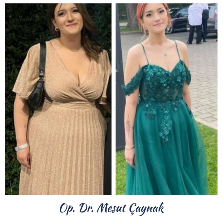 Before & After 4