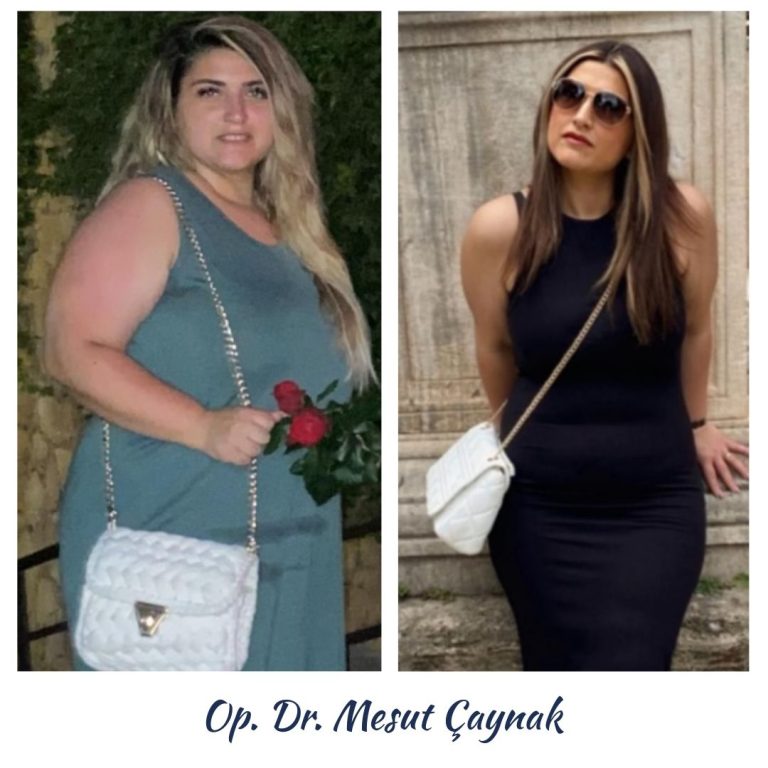 Before & After 5