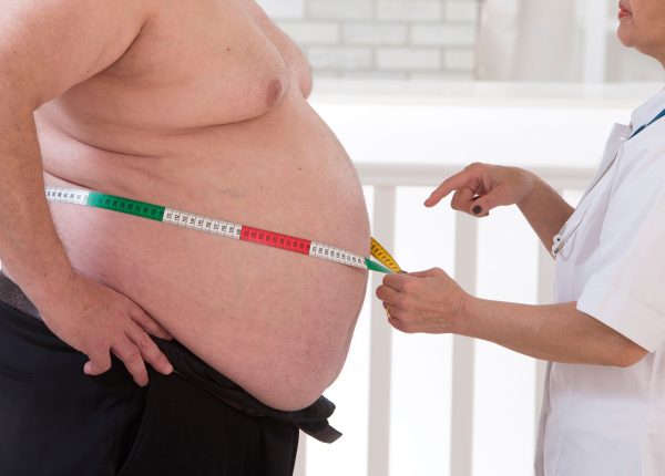 What is the BMI requirement for weight loss surgery