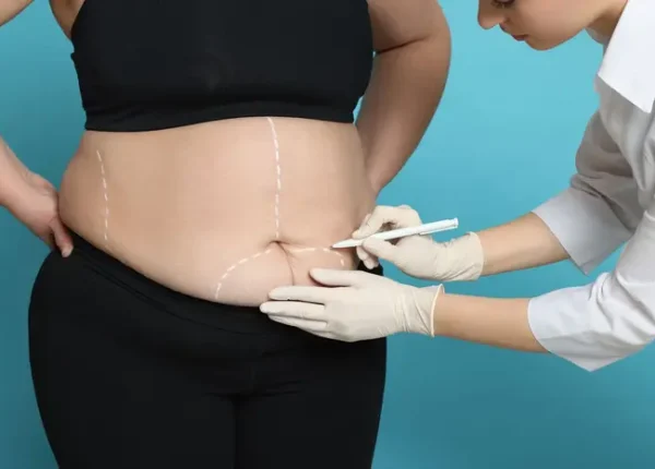 cheapest-countries-for-gastric-sleeve