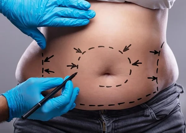 cheapest-countries-gastric-sleeve