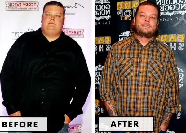 corey-harrison-gastric-bypass-celebrity-weight-loss-surgery