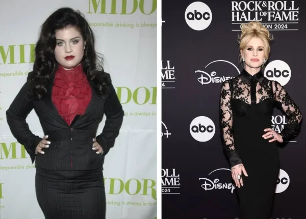 kelly-osbourne-bariatric-surgery